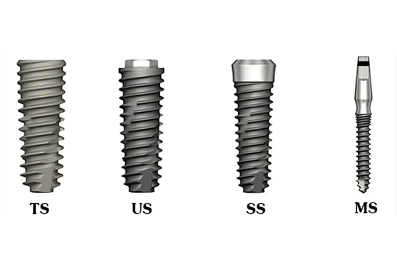 Виды имплантов Osstem
